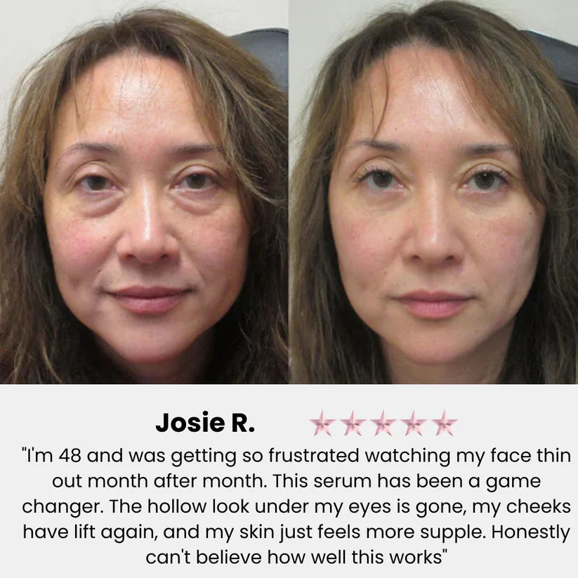 Korean Volufiline Deep Collagen Serum