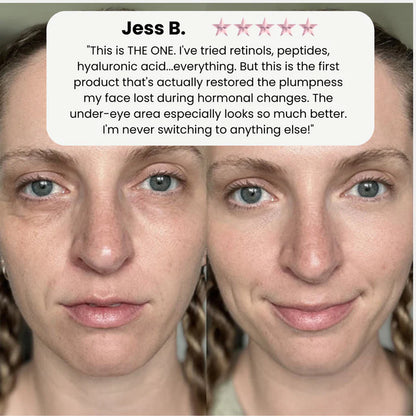 Korean Volufiline Deep Collagen Serum