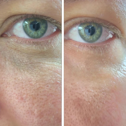 Korean Volufiline Deep Collagen Serum