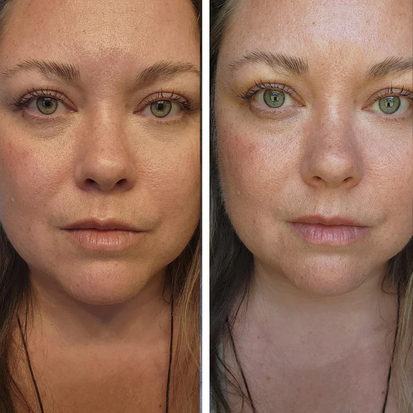 Korean Volufiline Deep Collagen Serum