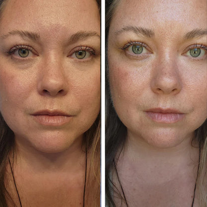 Korean Volufiline Deep Collagen Serum